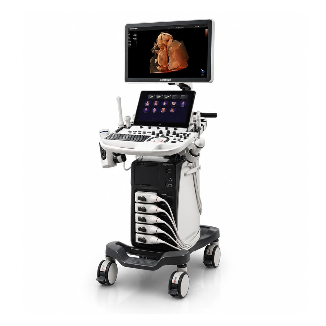 SonoScape P40 Elite