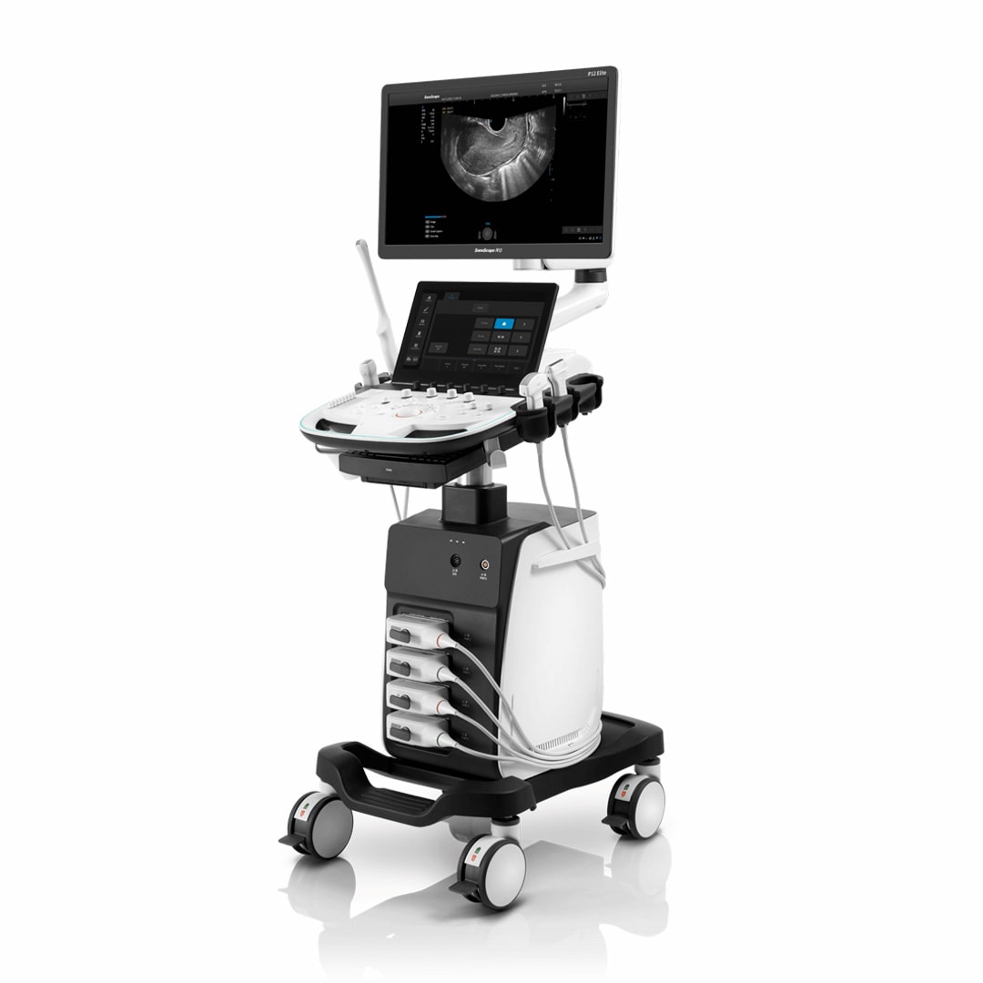 SonoScape P12 Elite