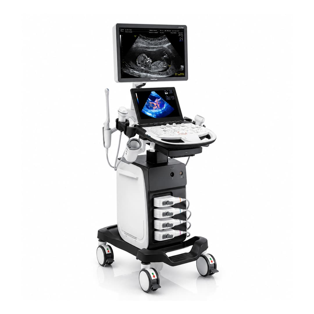 SonoScape P12 Elite
