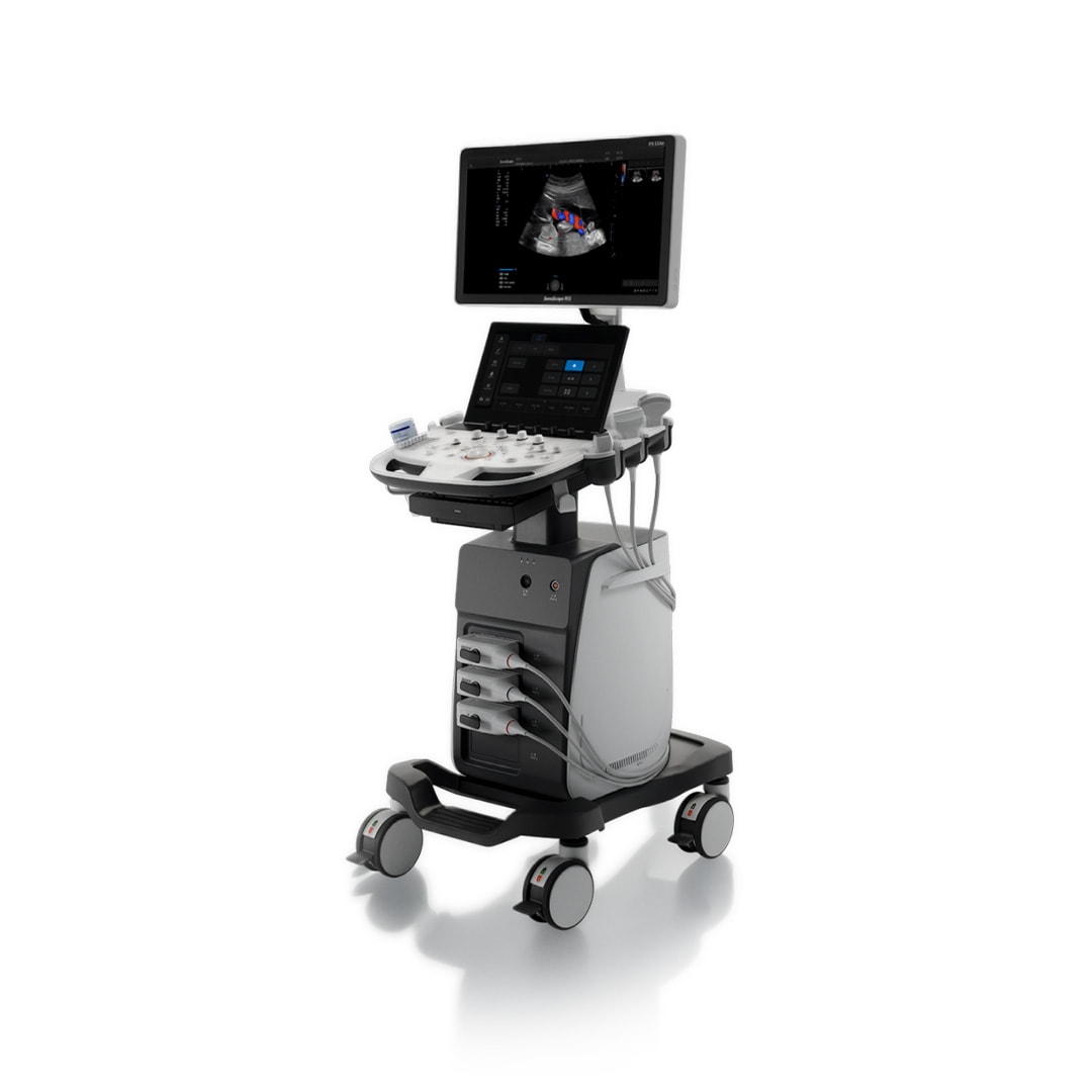 SonoScape P9 Elite