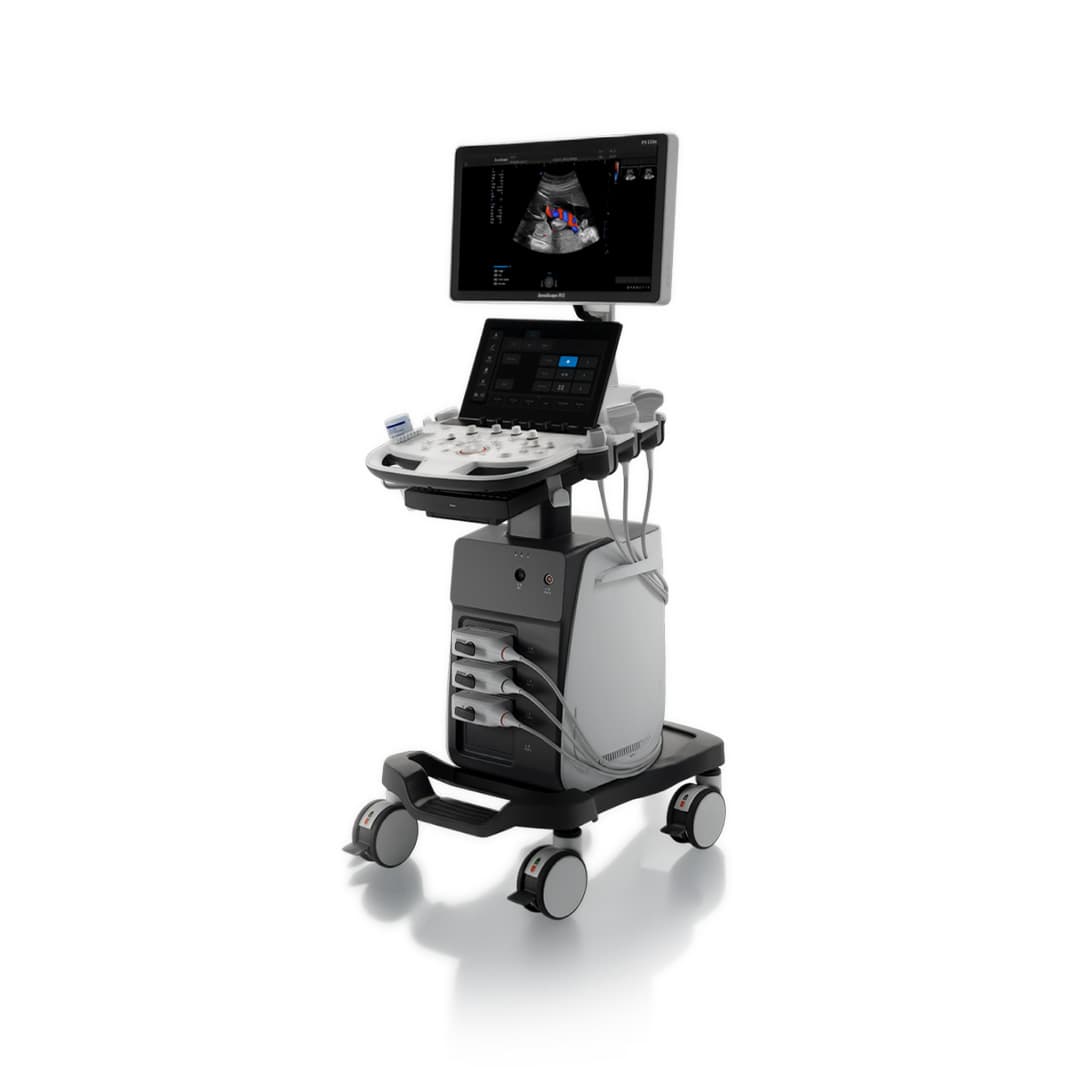 SonoScape P9 Elite